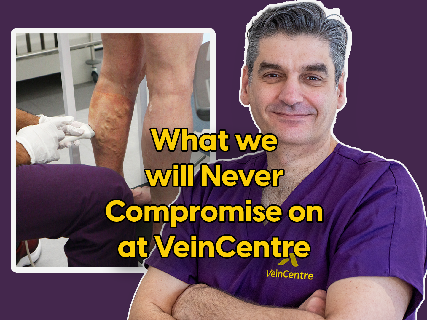 Varicose Veins Explained